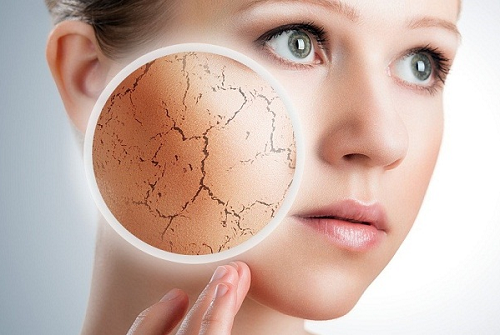 3 Biểu Hiện Của Da Khô Bạn Cần Biết
